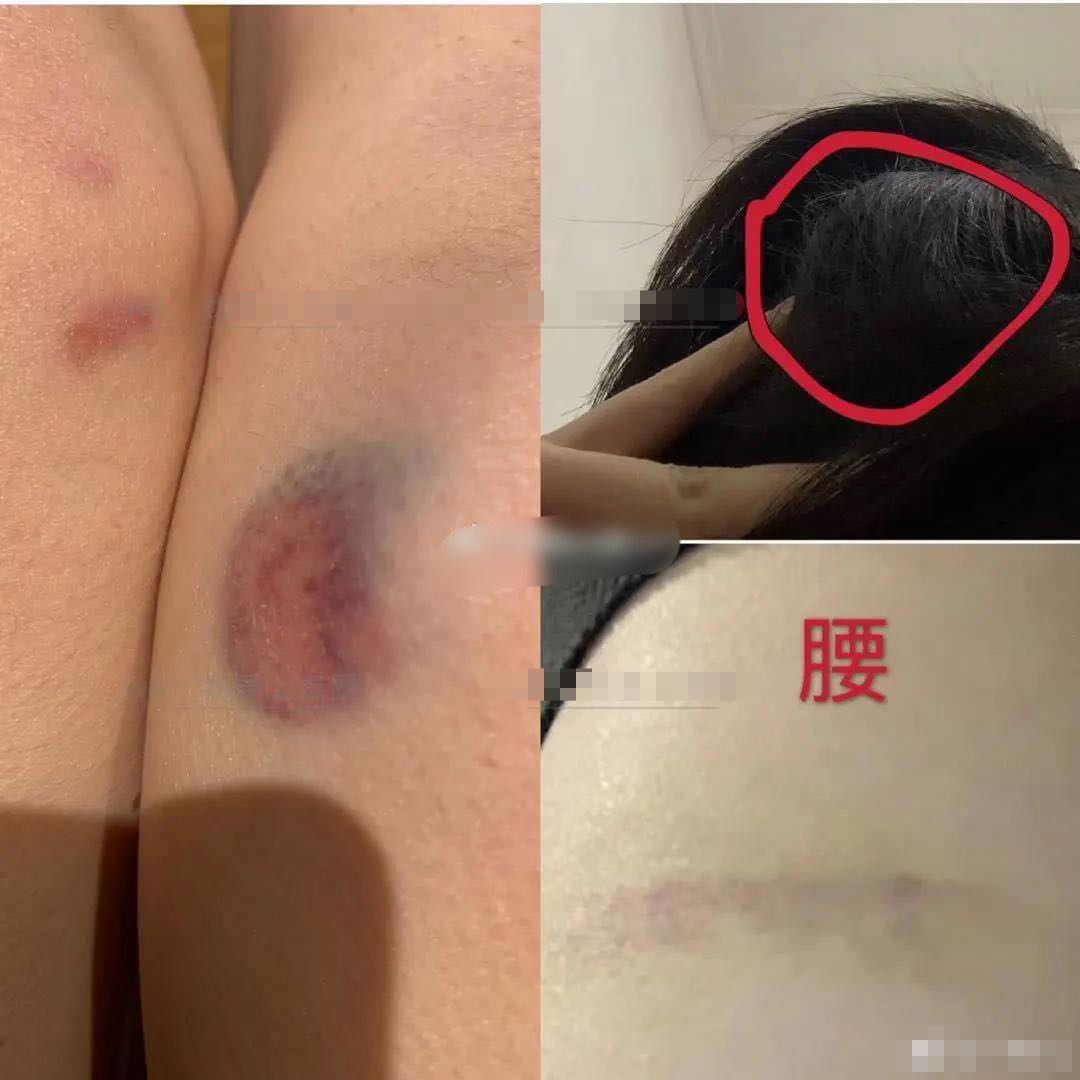 穿云箭多少钱一个