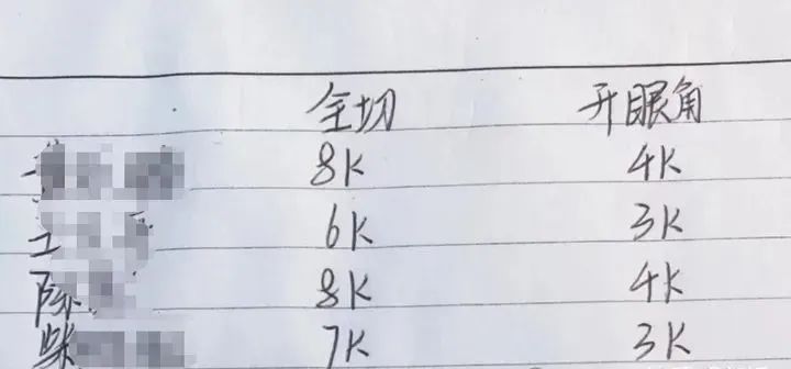 割双眼皮多少钱