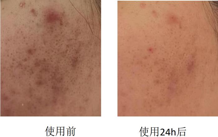 换季养肤指南