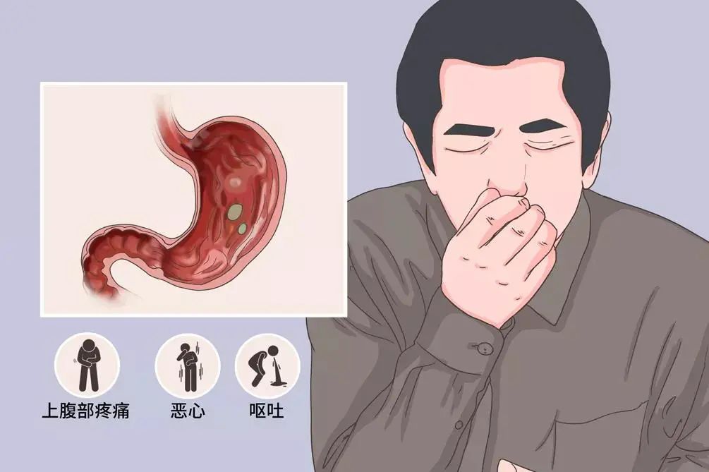 柿子和什么不能一起吃
