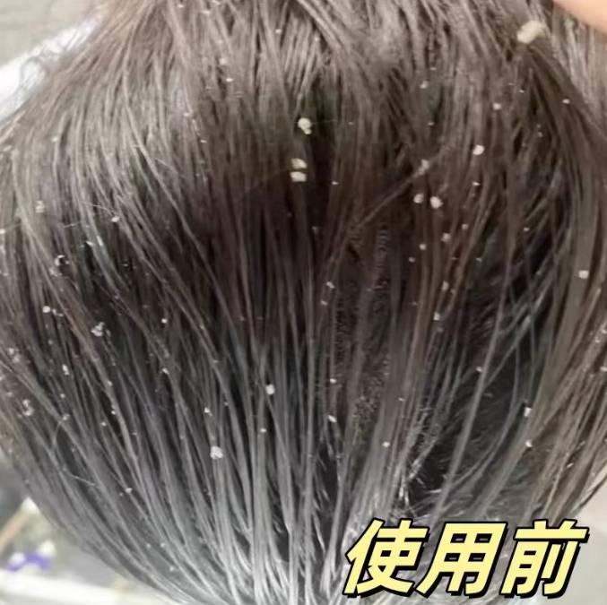对头发好的洗发水含什么