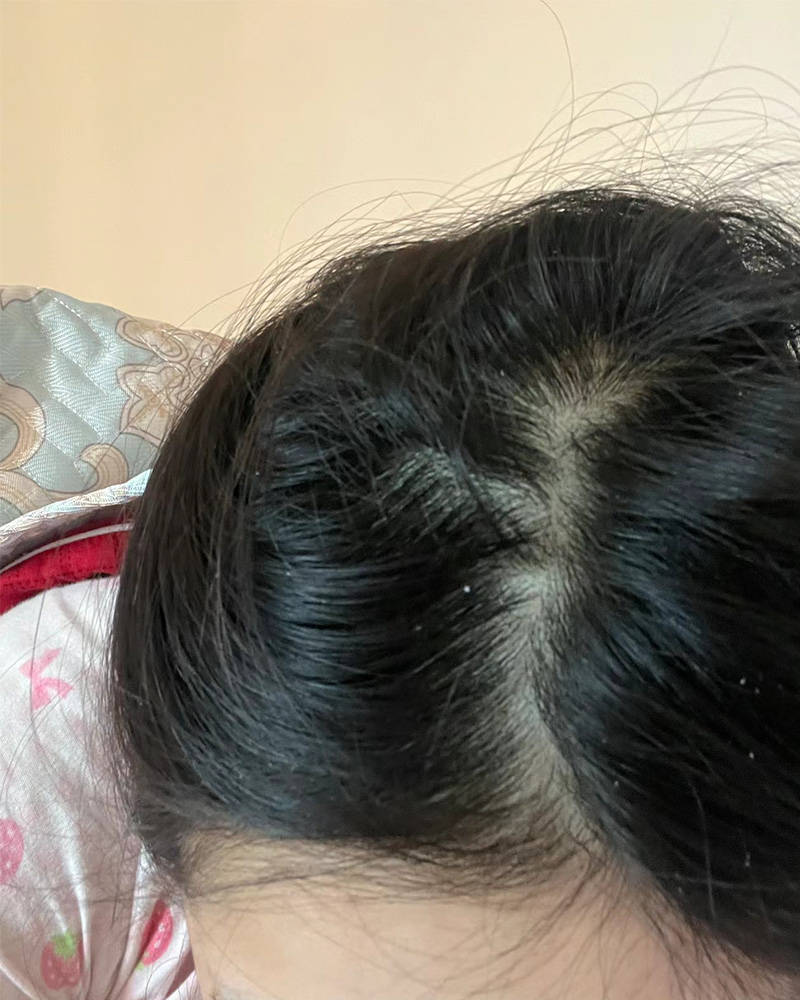 对头发好的洗发水含什么