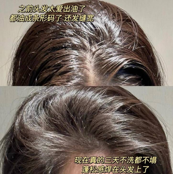 对头发好的洗发水含什么