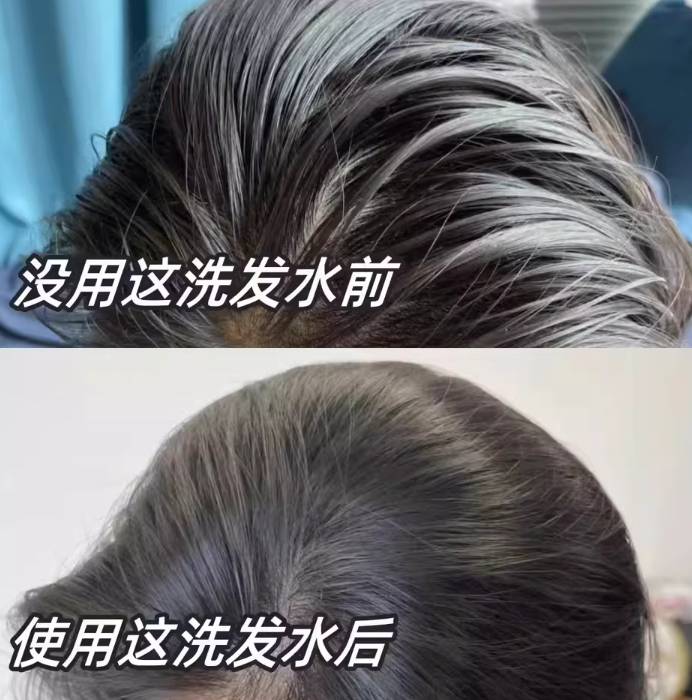 对头发好的洗发水含什么