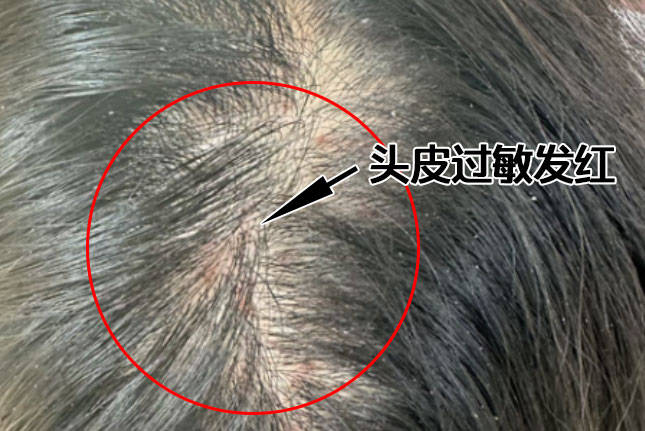 对头发最健康洗发水