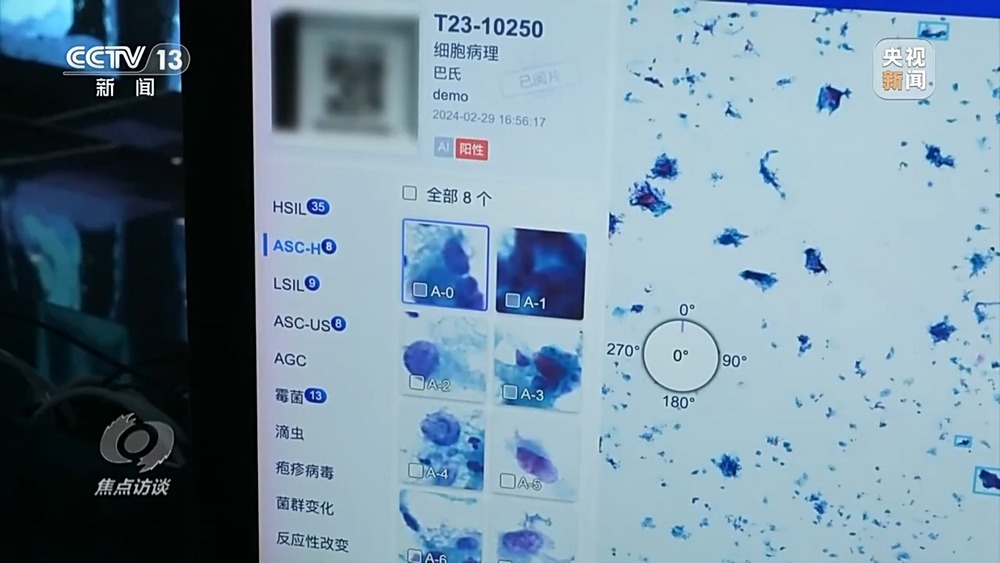 ai辅助诊断收费